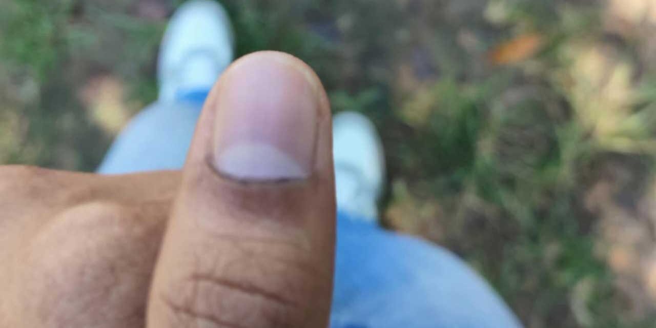 চাকসু নির্বাচন : মুছে যাচ্ছে কালি, অভিযোগ দেবে ছাত্রদল