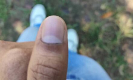 চাকসু নির্বাচন : মুছে যাচ্ছে কালি, অভিযোগ দেবে ছাত্রদল