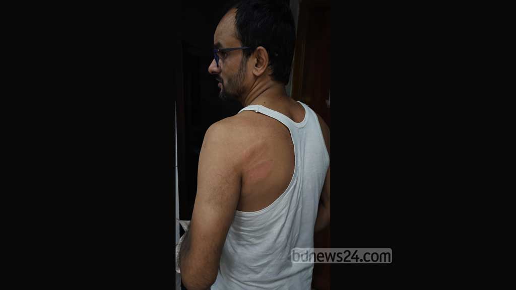 রাতে নরসিংদীতে বিডিনিউজ টোয়েন্টিফোরের প্রতিবেদকের ওপর হামলা